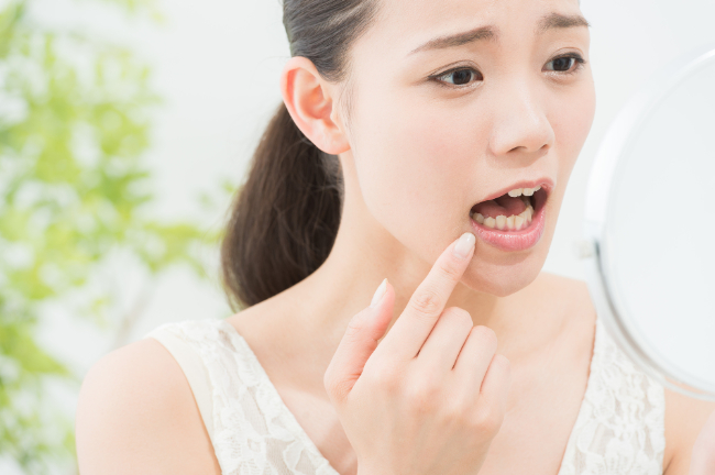 急に詰め物・被せ物が取れた・・<br>これって付け直せるの？