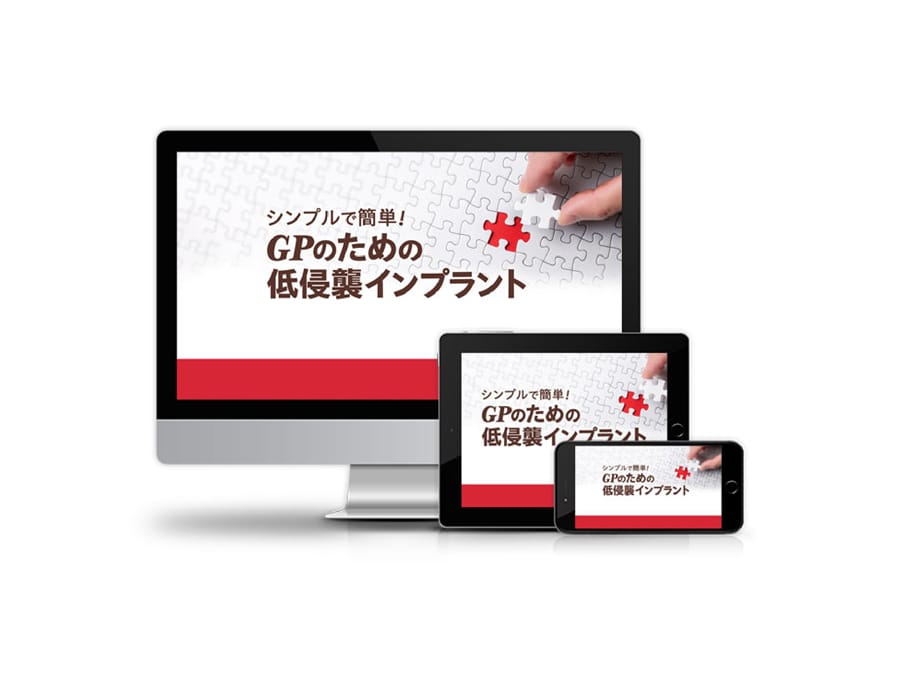 シンプルで簡単！<br>GPのための低侵襲インプラント