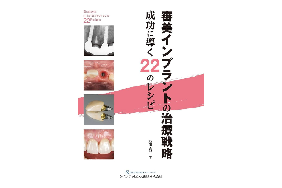 審美インプラントの治療戦略