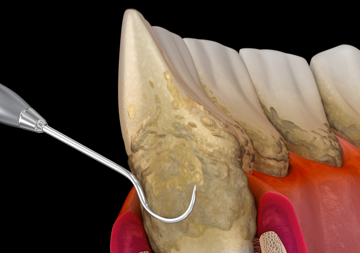 名駅ナディア歯科では先駆けて導入
