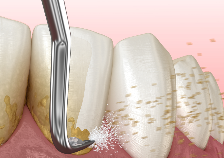 殺菌と清掃を同時に行える