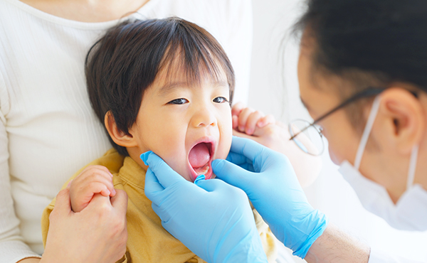 子どもの歯並びが気になったら…小児矯正を始めるタイミングと目安